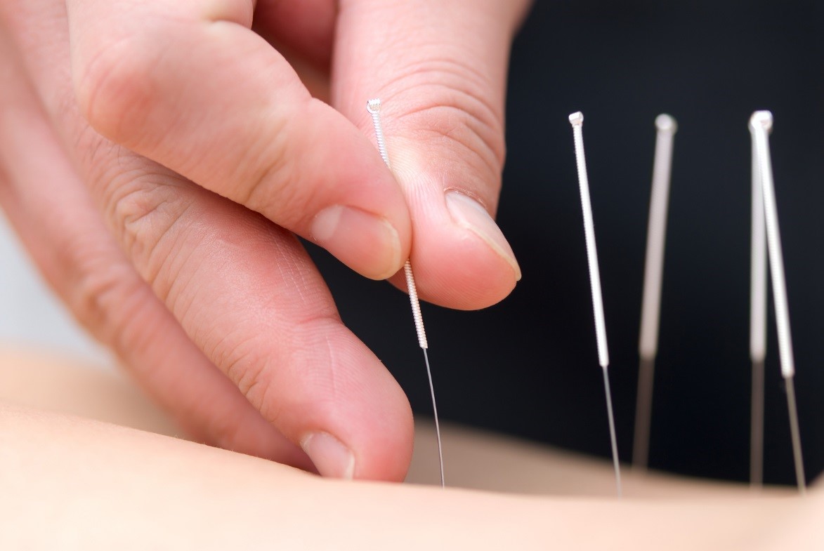 Is acupuncture the new treatment for cancer?
