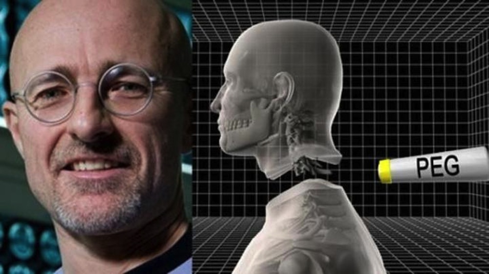 NHS neurosurgeon focused on achieving the world’s first human head transplant by 2030
