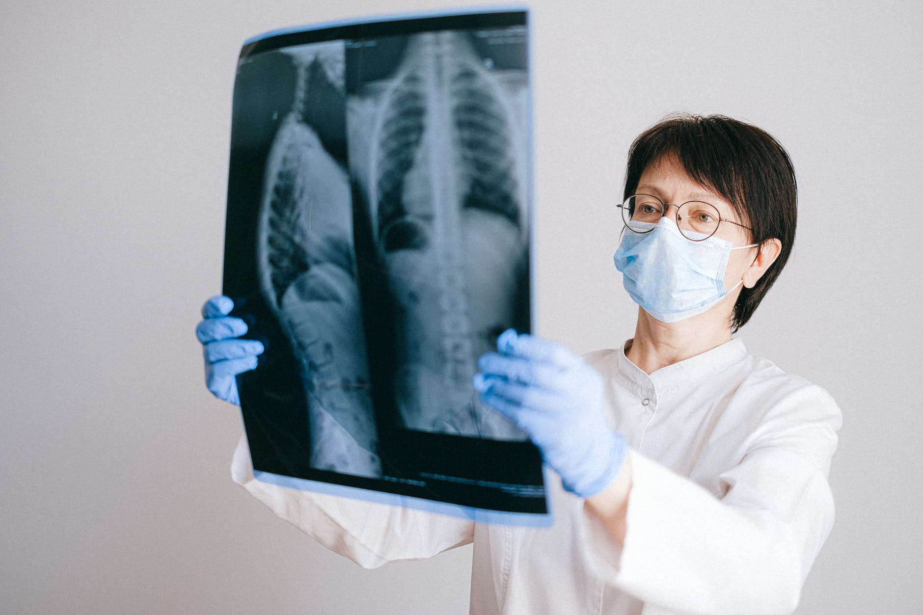 a doctor looking at an x ray result